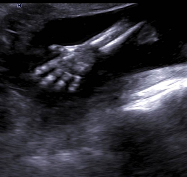 Do Olomouce se sjeli gynekologové z celé republiky